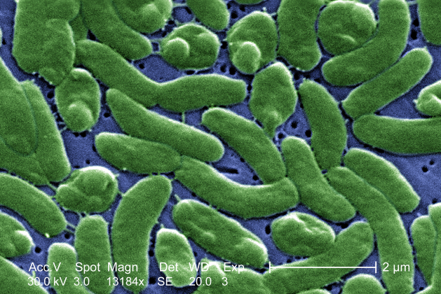 False color scanning electron micrograph of w:en: Vibrio vulnificus bacteria (courtesy of CDC Image Library / James Gathany (PHIL #7815), Public domain, via Wikimedia).